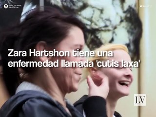 La mujer de 21 años que parece una anciana