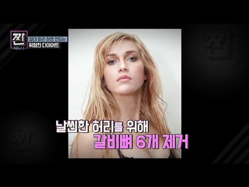 위험천만 다이어트! 갈비뼈 6개를 제거했다?![B급 뉴스쇼 짠] 9회 20160730