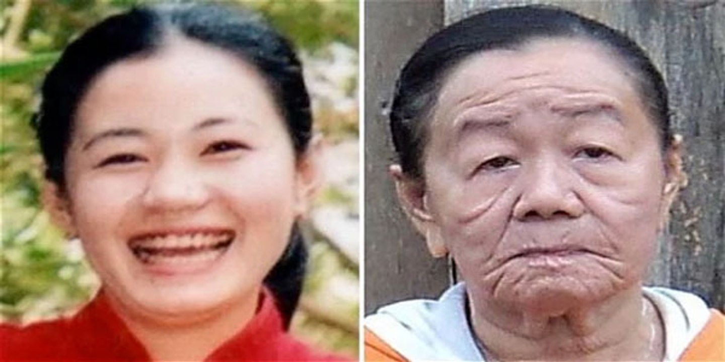 Cette femme de 26 ans devient 50 ans en une seule nuit. (Maladie étrange)