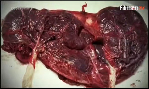 Encounters with Evil - S01E07 Flesh Eaters