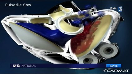 Coeur artificiel : Carmat peut reprendre ses essais cliniques