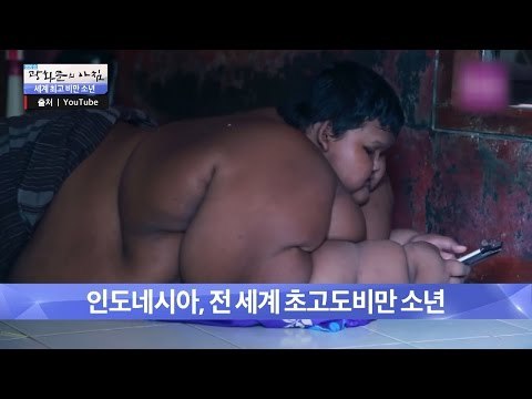 147cm, 192kg 전 세계 초고도비만 소년! [광화문의 아침] 274회 20160714