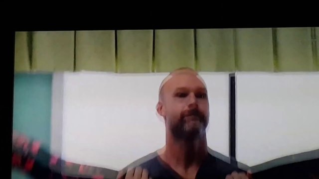 Une danseuse de Danse avec les Stars USA lache une caisse au visage de son partenaire