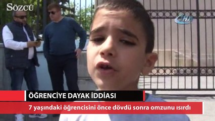 Öğretmen, 7 yaşındaki öğrencisini ısırdı iddiası