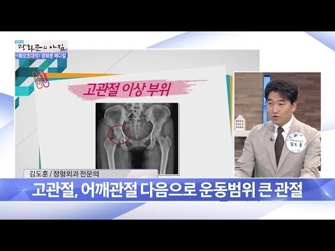 고관절 어떤 뼈일까? [광화문의 아침] 262회 20160628