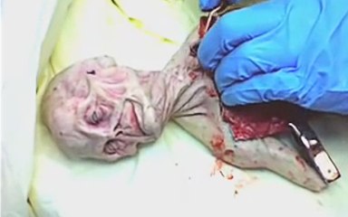 Alien Autopsy 1966 KGB