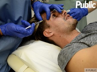 Exclu Vidéo : Benoît Dubois : "La médecine esthétique me coûte jusqu’à 1000 euros par an !"