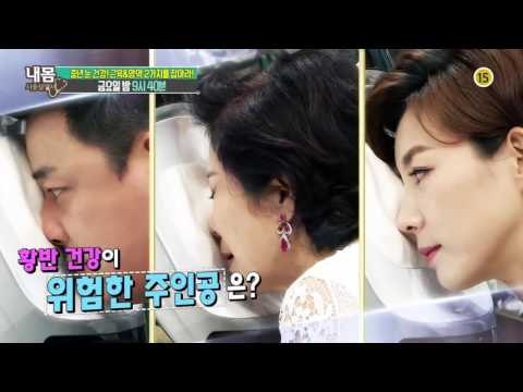 중년 눈 건강의 모든 것!_내 몸 사용설명서 108회 예고