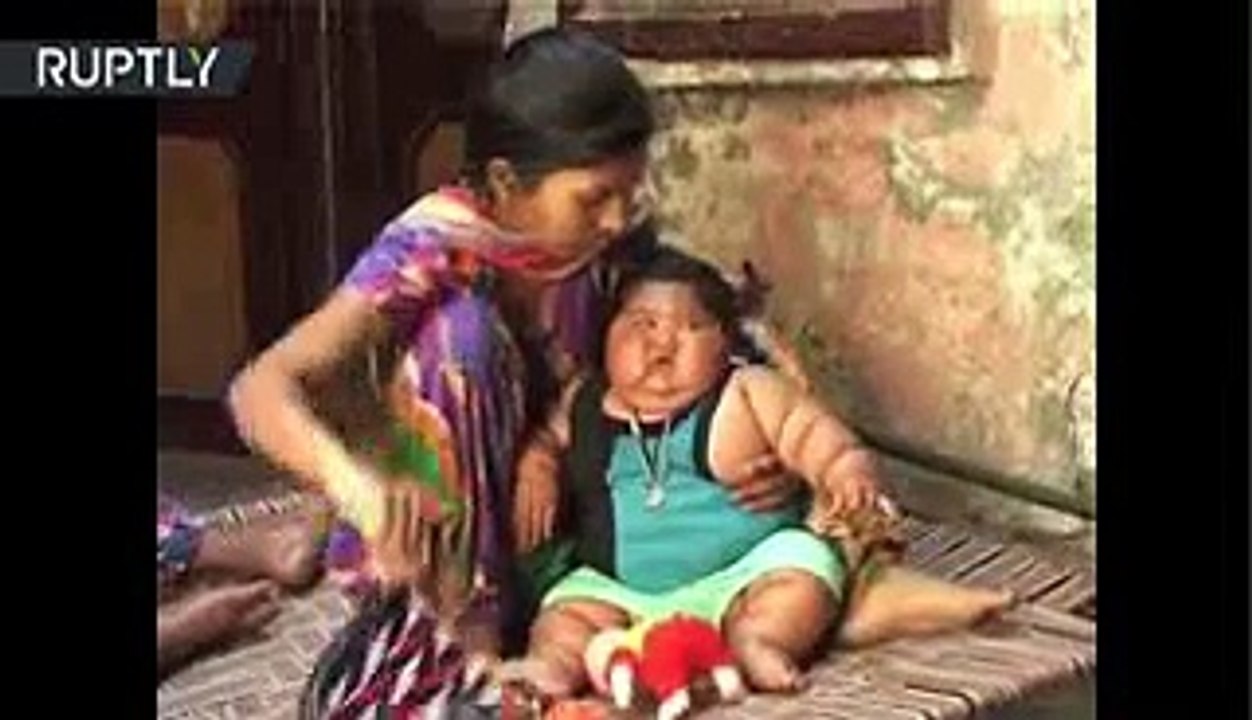 Come como una niña de 10 años_ La historia de una bebé de 8 meses que pesa 17 ki