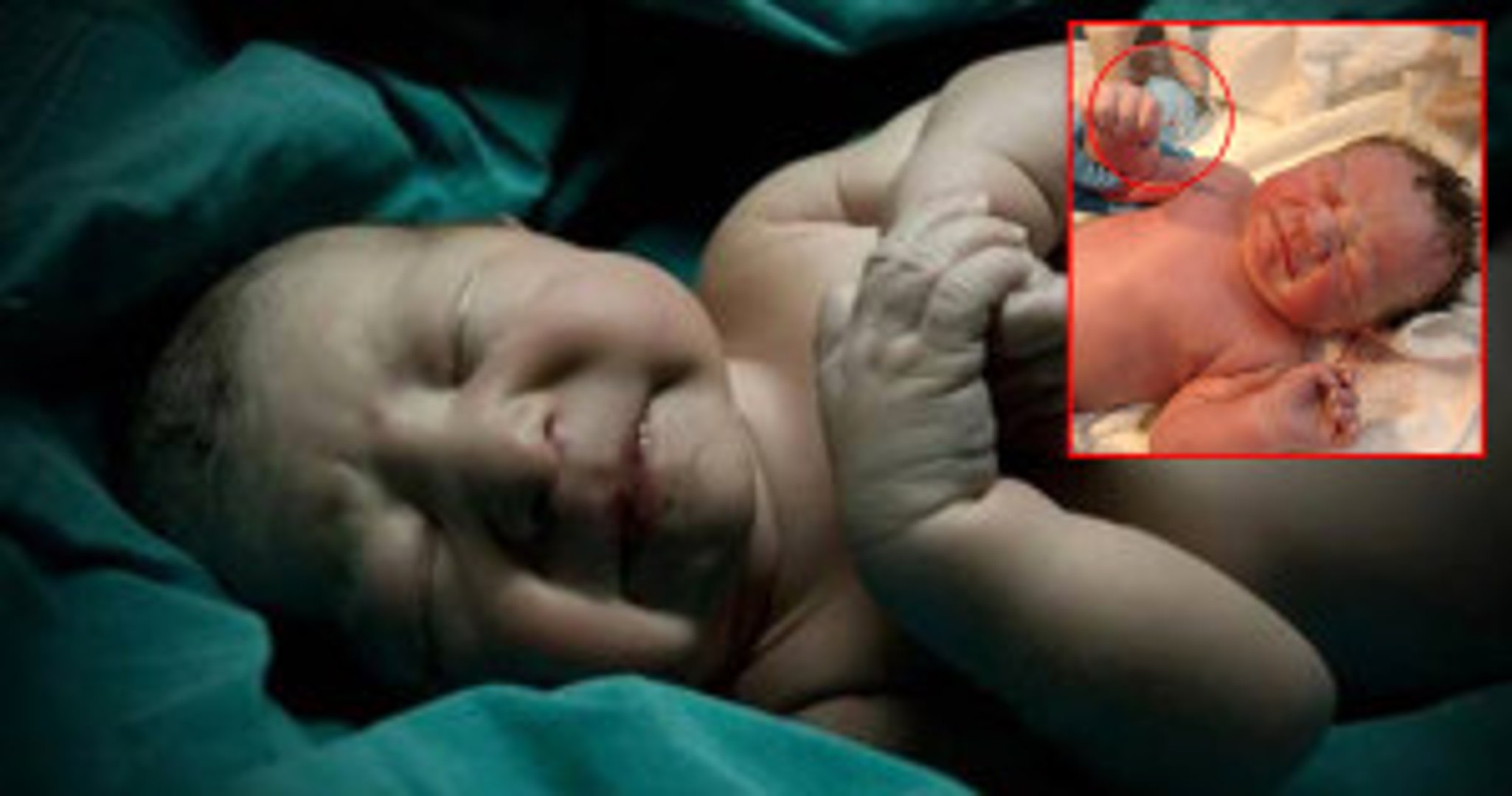Yeni Doğan Bebek Elinde Annesinin Taktırdığı Spiral Dünyaya Geldi -  Dailymotion Video