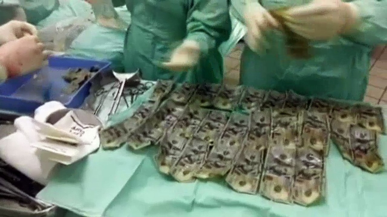 incroyable découverte dans son estomac