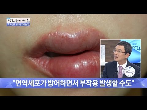 쁘띠성형, 과연 안전할까? [광화문의 아침] 240회 20160526