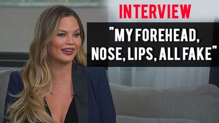 Chrissy Teigen SHOCKING Interview | Reveals All About Plastic Surgeries