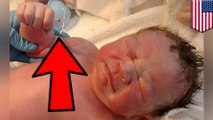 Whoops! Newborn holds mom’s ‘99.9% effective’ IUD in hand