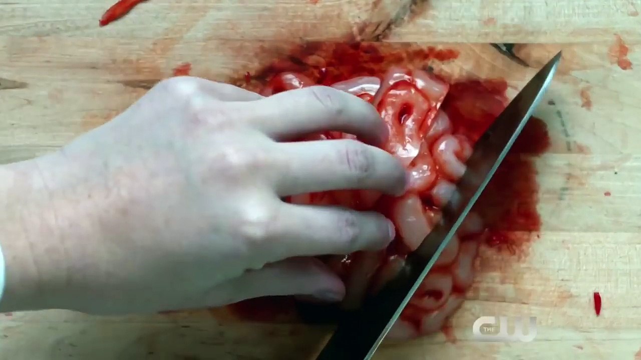 iZombie 3x06 Extended Promo 'Some Like It Hot Mess' (HD) Season 3 Episode 6 Extended Promo