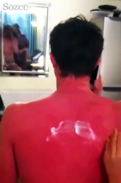 Siz siz olun güneşte bu kadar kalmayın