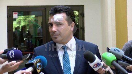 Paralajmërimi për heqjen e testimit ekstern pritet mirë nga LASH-i