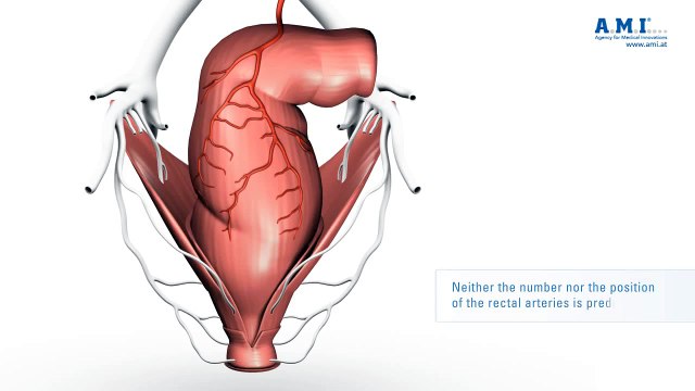 Hemorrhoids treatment. How to treat hemorrhoids at home. Hemorrhoids symptoms and signs