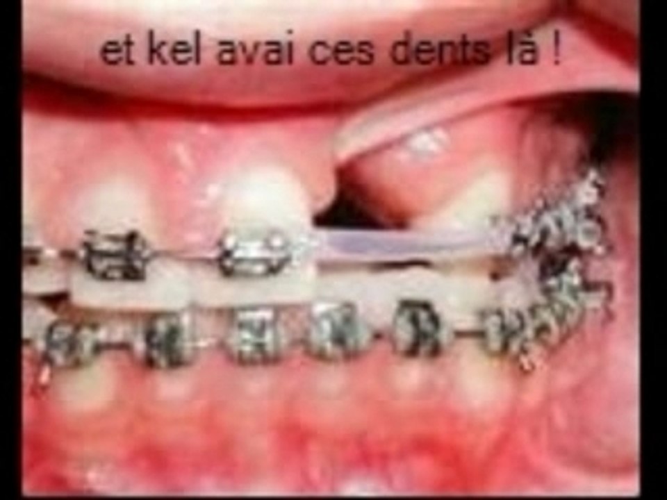 Photorécit3