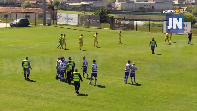 Un joueur de Canelas casse le nez de l'arbitre et prend 4 ans de suspension !