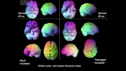 Na rubu znanosti - Neuroplastičnost mozga i moć uma