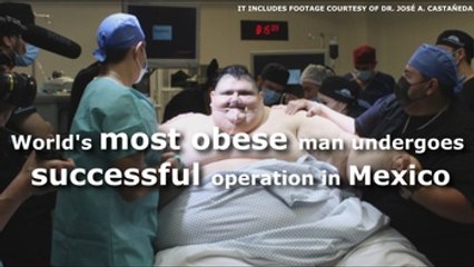 World's most obese man undergoes successful operation in Mexico