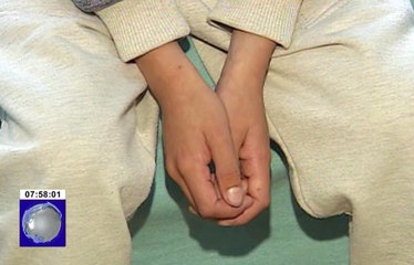 Niño sufre de dolores en su pecho producto de una operación a corazón abierto