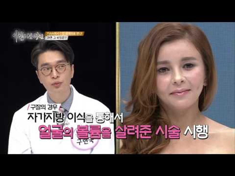 A컵에서 C컵으로 변신! 비포 앤 에프터는?[아름다운 당신 시즌2] 7회 20160416