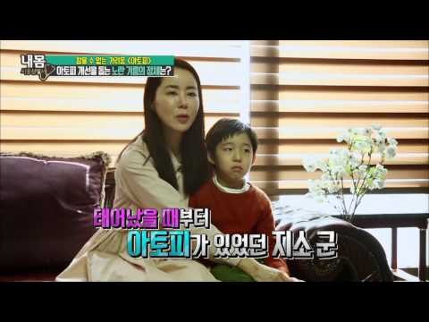 아토피 개선을 돕는 노란 기름 [내 몸 사용 설명서] 97회 20160408