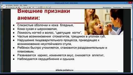 Железодефицитная анемия у детей. Питание при анемии