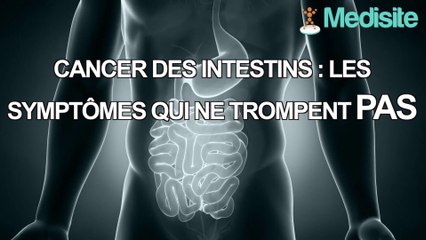 Cancer des intestins : les symptômes qui ne trompent pas