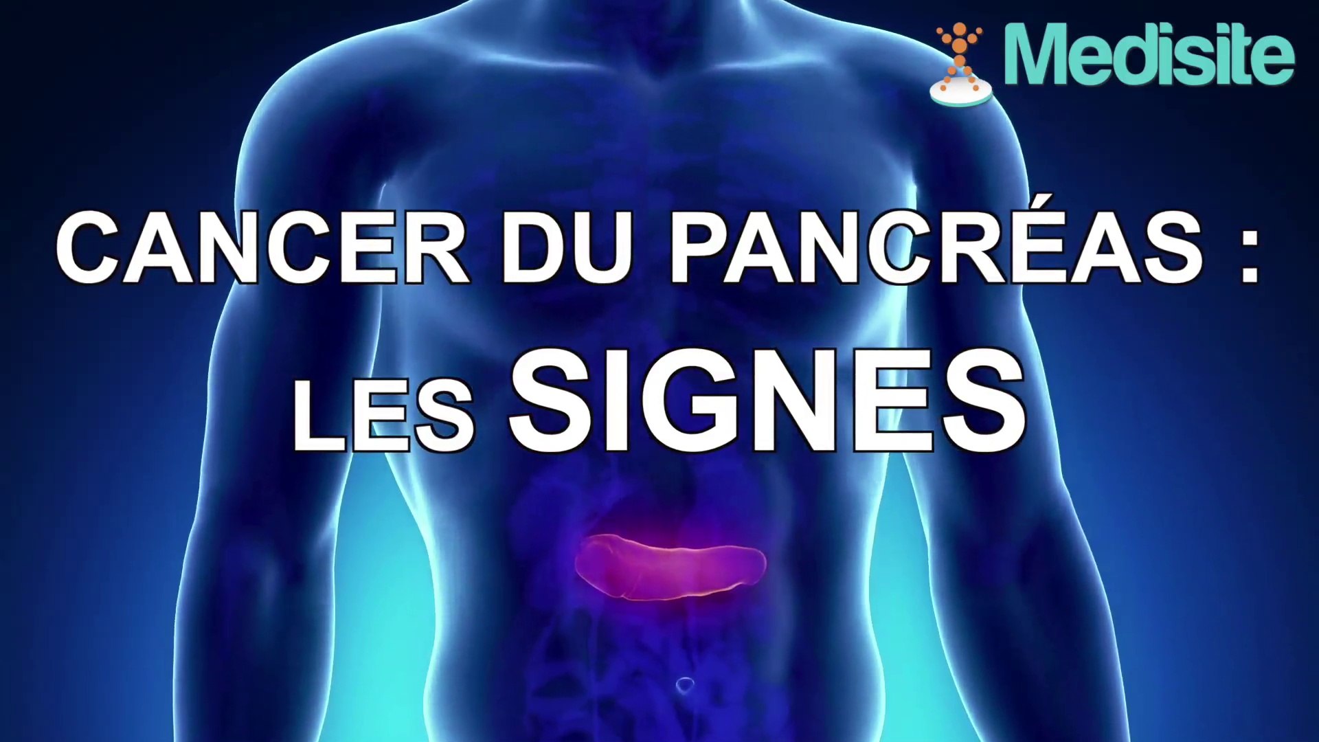 Cancer du pancréas : les signes - Vidéo Dailymotion