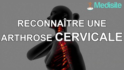 Reconnaître une arthrose cervicale