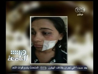 #هنا_العاصمة | معلمة تتعرض للضرب من مدير المدرسة .. شاهد السبب