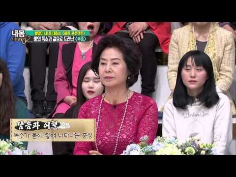 몸의 붓기는 독소다?! [내 몸 사용 설명서] 94회 20160318