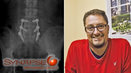 Update | 2 weeks after Lumbar Fusion Surgery by Edwin Haronian MD