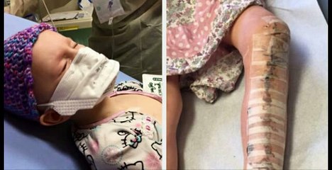 Médicos creen que la niña se quejaba sólo por dolor de crecimiento, hasta que encuentran esto en su pierna