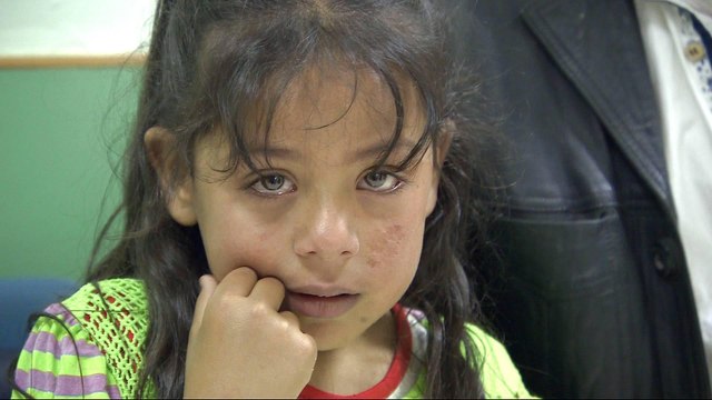 Lebanon: Fears as ‘Aleppo boil’ disease spreads