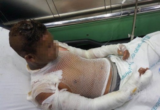 Cami Tuvaletinde Çakmak Gazı Patladı: 4 Çocuk Yaralı