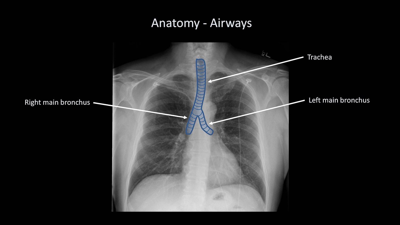 How to Interpret a Chest X-Ray (Lesson 2 - A Systematic Method and Anatomy)