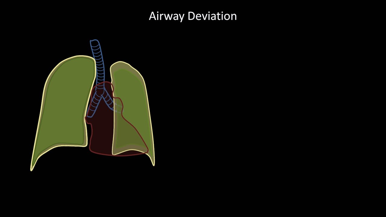 How to Interpret a Chest X-Ray (Lesson 4 - Airways, Bones, and Soft Tissues)