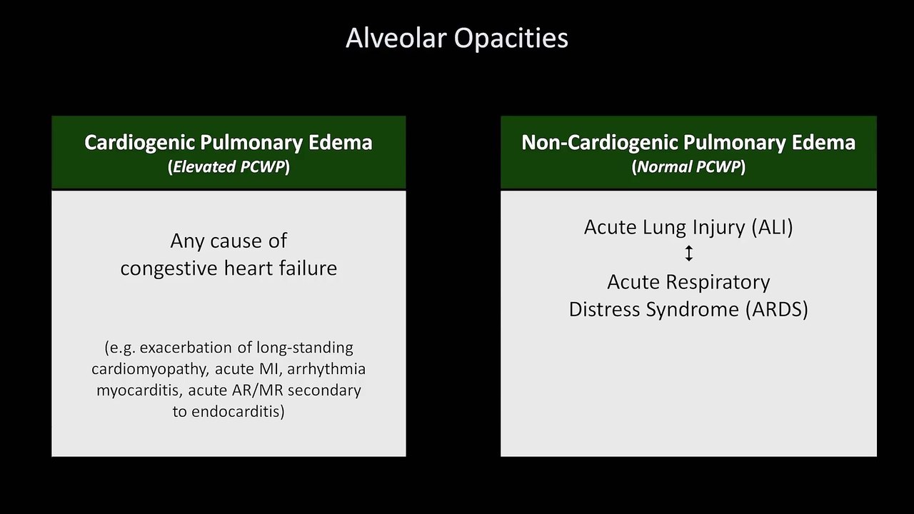 How to Interpret a Chest X-Ray (Lesson 7 - Diffuse Lung Processes)
