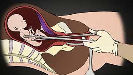 Esto Sucede Cuando una Madre Decide No tener su Bebe!