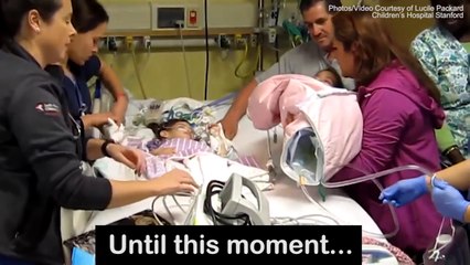 The moment conjoined twins see each other aft