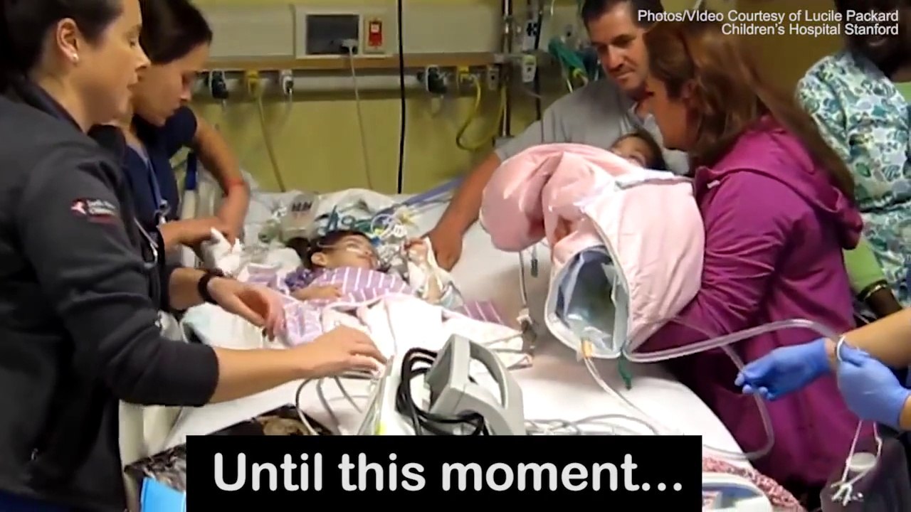 The moment conjoined twins see each other aft