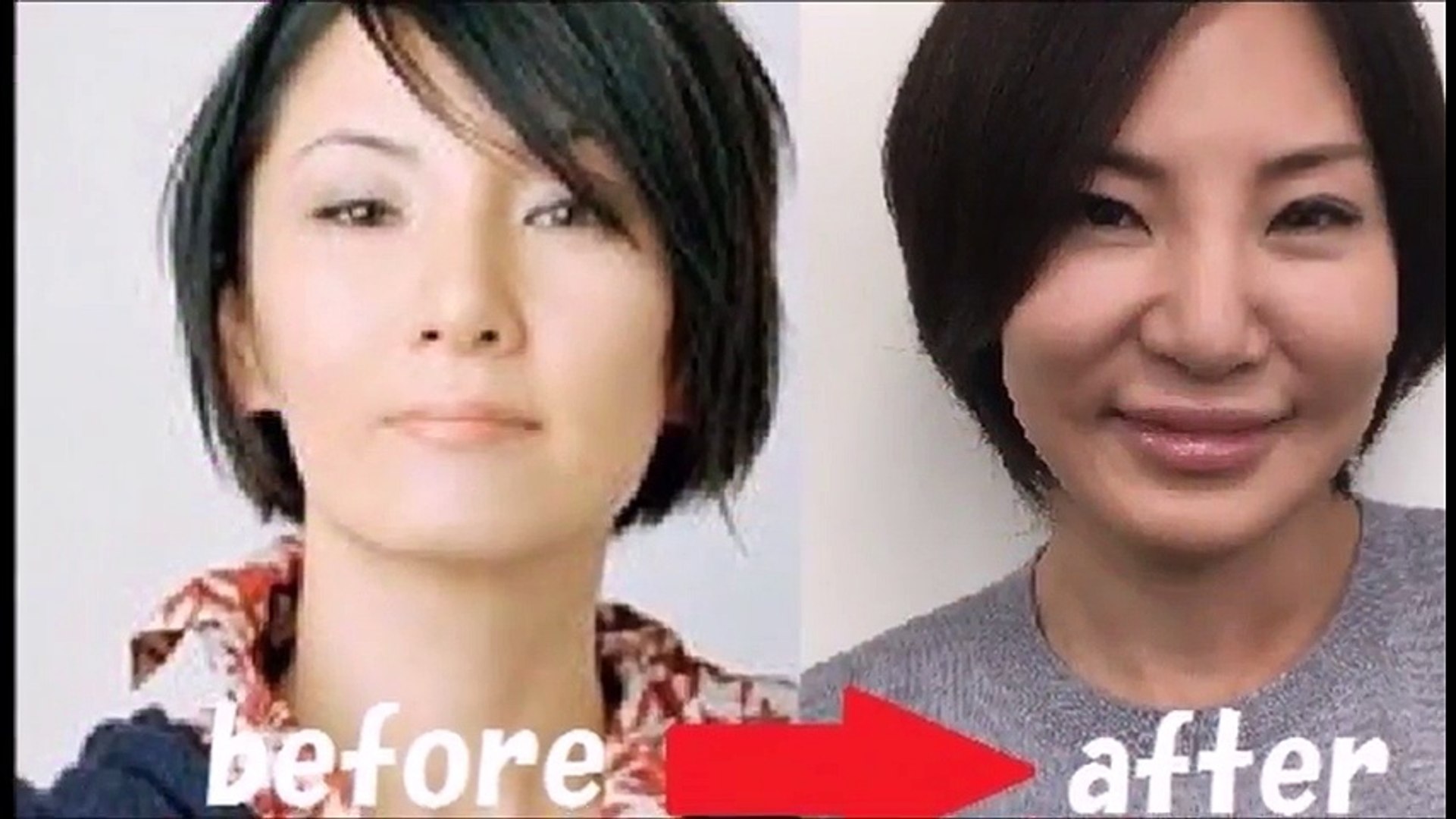 整形しすぎ芸能人 広瀬香美 目頭切開 顔面崩壊 原形がない別人 Video Dailymotion