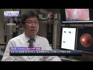 침묵의 눈 살인자 '녹내장'  [광화문의 아침] 129회 20151209