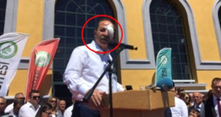 Edirne Belediye Başkanı'na Selfie Sırasında Yumruklu Saldırı