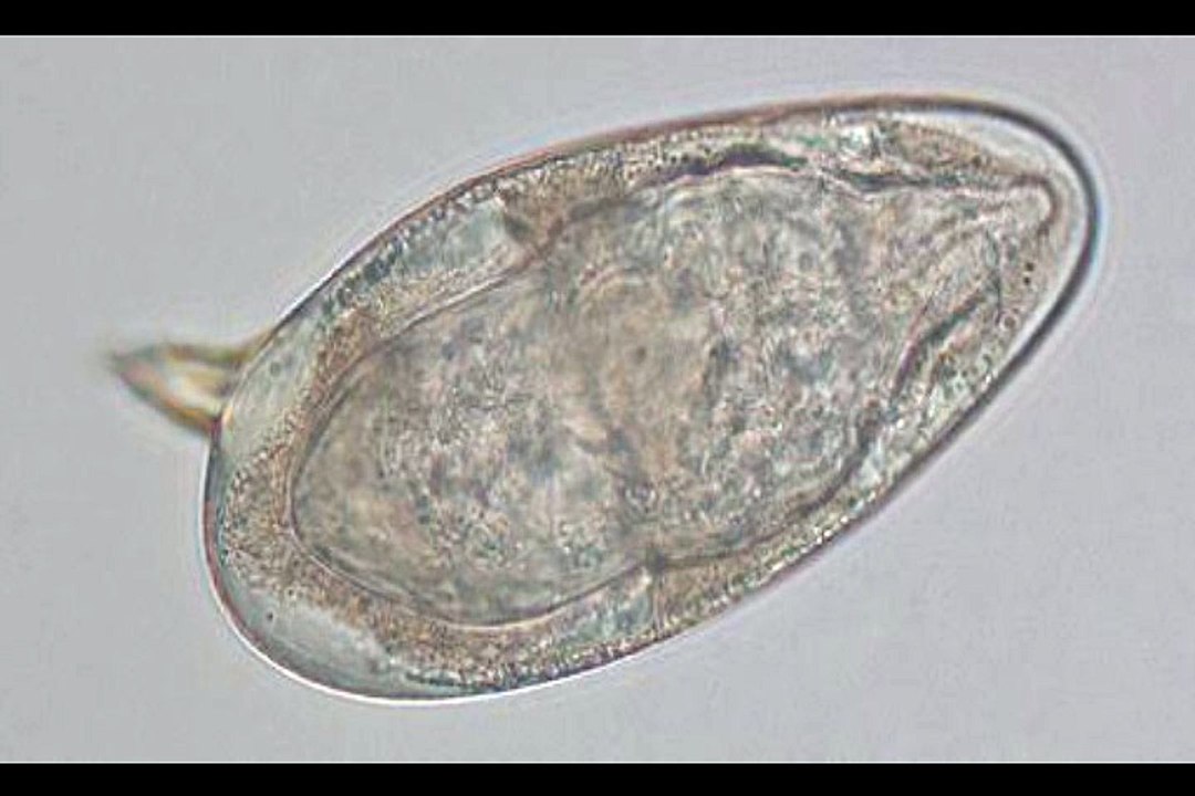 Ovos Schistosoma mansoni