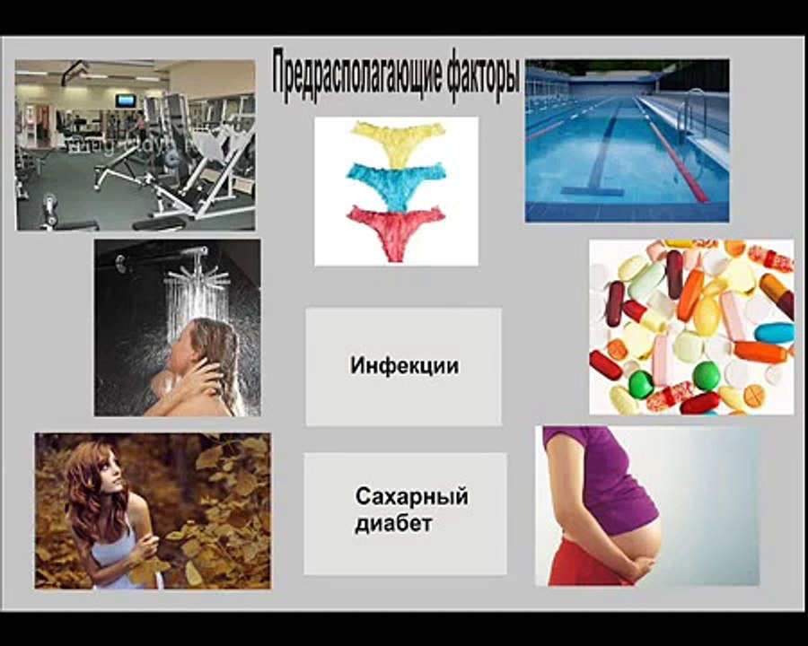 Методы лечения молочницы. Как вылечить молочницу народными средствами